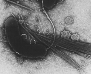 cholerae-full TEM image of vibrio cholerae
