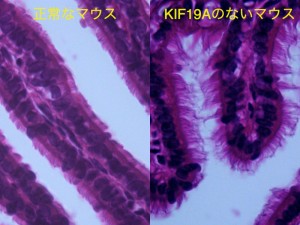 野生型マウスとKIF19Aノックアウトマウスの卵管の顕微鏡像 © Nobutaka Hirokawa and Shinsuke Niwa