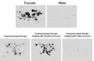 Estrogen receptor in a brain area implicated in sexual behavior in medaka fish. © Kataaki Okubo Estrogen receptor in a brain area implicated in sexual behavior in medaka fish. © Kataaki Okubo