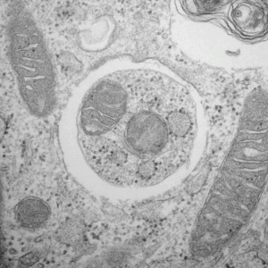 Cytoplasmic components surrounded by an autophagosome. Cytoplasmic components surrounded by an autophagosome