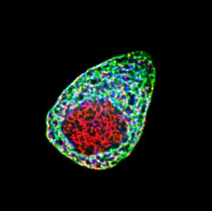 © 2014 Wenxing Yang, Yosuke Tanaka and Nobutaka Hirokawa. Superresolution image of the anti-diabetic protein complex in beta cells. KIF12 kinesin (green) simultaneously binds to the stress-regulating protein (blue) and its transcription factor (red) to maintain their expression levels. Overnutrition may disrupt this complex by KIF12 downregulation, resulting in progress of diabetes.