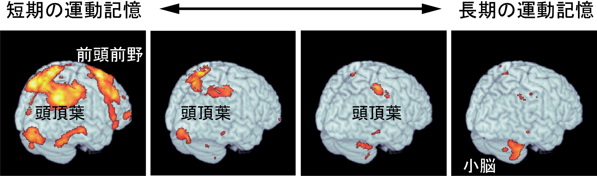 短期から長期の異なる運動記憶が脳内に分布する様子 © 2015 今水 寛脳を右斜め後ろから見た図。練習時間が増えるにつれて、左の図から右の図へと運動記憶に関係する脳の場所が変わる。
