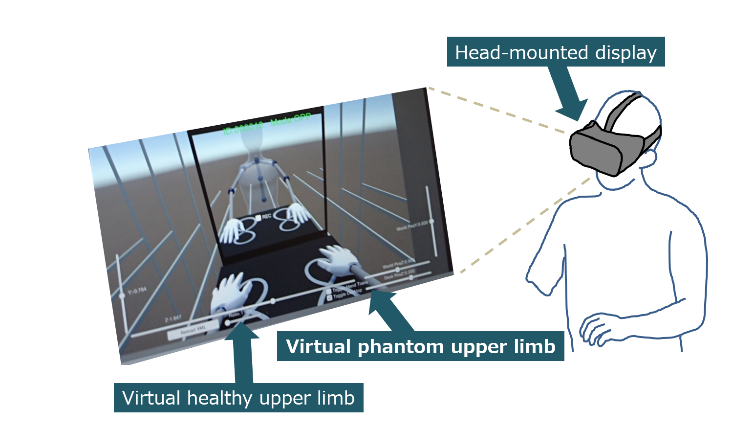 Neurorehabilitation with a virtual reality system Neurorehabilitation with a virtual reality system