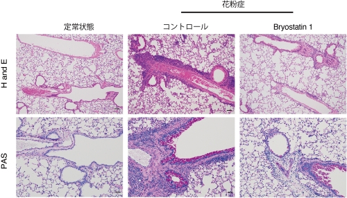 Lung tissue