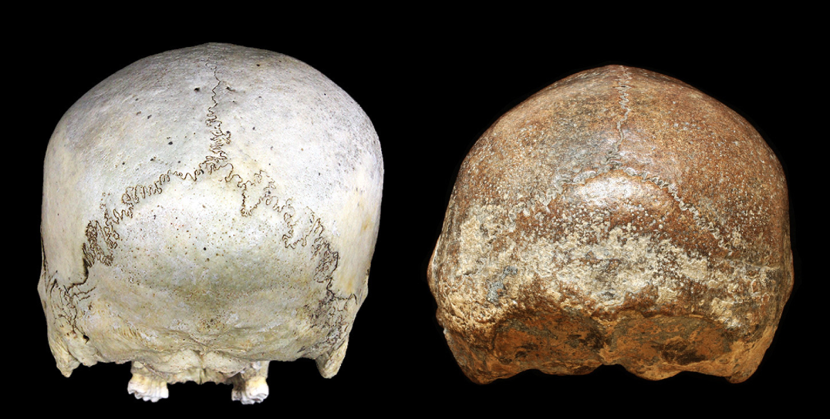Side by side photo of a historic human skull and a fosillized skull, showing deformation.